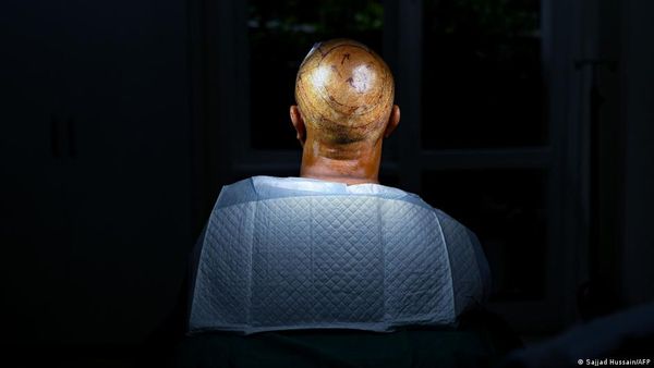 सूअर के लिवर को इंसान जैसा बनाने की कोशिश