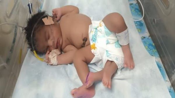 MP news : ग्वालियर में चार पैर वाली बच्ची का जन्म, देखने वालों की उमड़ी भीड़