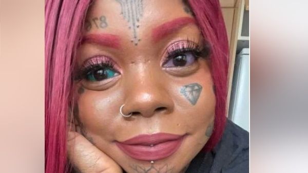 OMG महिला ने आंखों की पुतलियों पर गुदवाया बैंगनी-नीला Tattoo, अब हुआ ये हाल