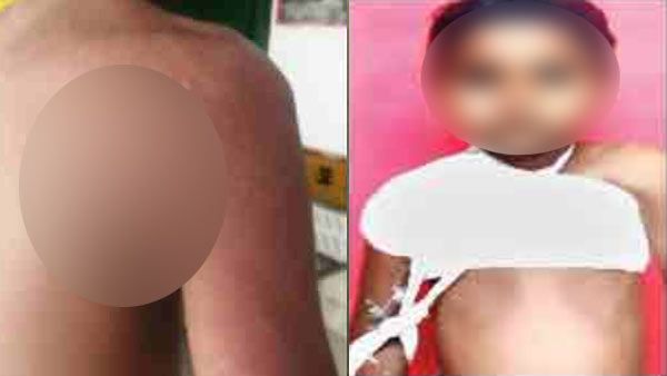 Jaunpur News: शिक्षक ने मासूम छात्र को बेरहमी से पीटा, पसली टूटी, अस्पताल में भर्ती