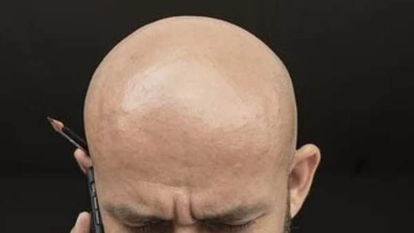 बॉस ने गंजेपन की वजह से अपने कर्मचारी को निकाला, कोर्ट ने सिखाया सबक, अब देने होंगे इतने लाख