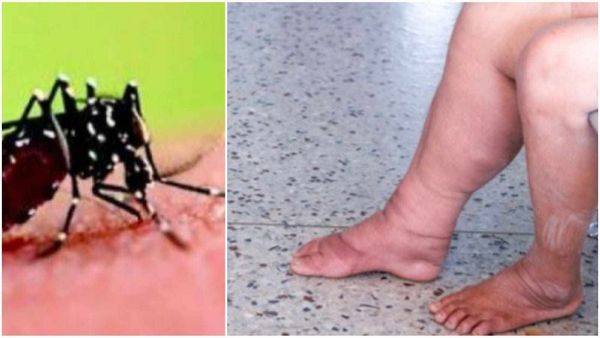 क्यूलेक्स मच्छर के कारण मप्र के 12 जिले बने संवेदनशील, हाथीपांव का खतरा