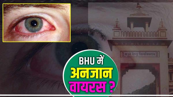 BHU के राजाराम छात्रावास में अनजान वायरस से हड़कंप, आंखों से नहीं देख पा रहे 50 छात्र