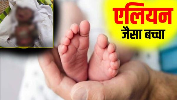 Jaunpur News: महिला ने 'एलियन' जैसे बच्चे को दिया जन्म, डॉक्टर और माता-पिता भी हैरान