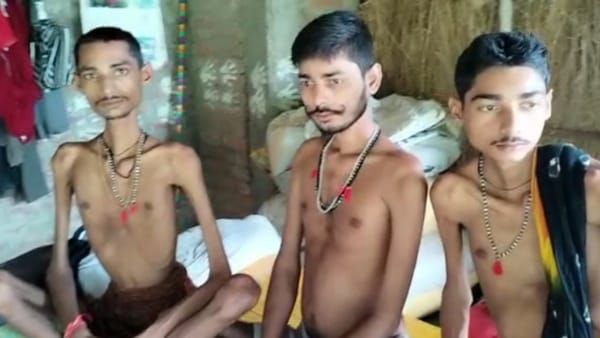 Muscular Dystrophy: दुर्लभ बीमारी से हड्डियों का ढांचा बना पूरा परिवार, जर्मनी में इलाज कराएंगे सीएम शिवराज