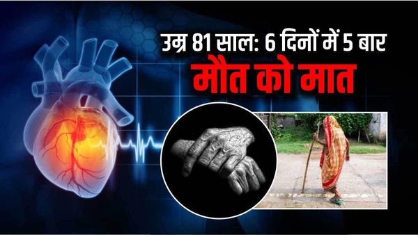 Delhi: सिर्फ 6 दिनों में 5 बार कार्डियक अरेस्ट, फिर भी 81 साल की महिला ने दी मौत को मात