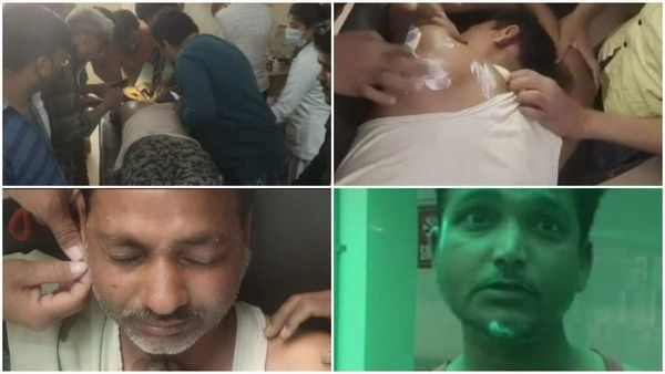 Tikamgarh: अंतिम संस्कार के दौरान मधुमक्खियों का हमला, श्मशान से सीधे अस्पताल पहुंचे दर्जनों लोग