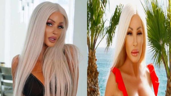 कभी Barbie जैसी दिखने के लिए करवाई थी करोड़ों की सर्जरी, ऐसा क्‍या हुआ कि Playboy मैगजीन मॉडल हुई कंगाल