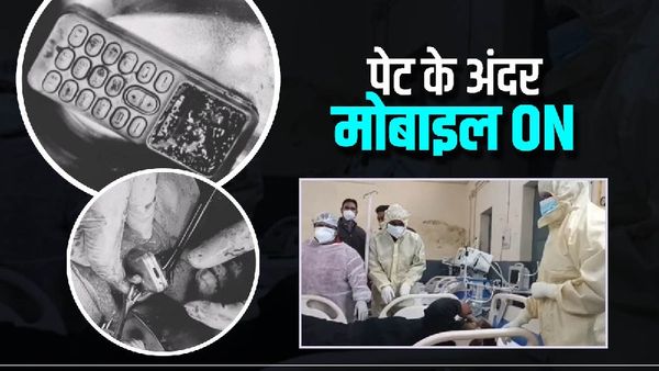 OMG: भाई से झगड़ा हुआ तो बहन ने हाथ में पकड़ा मोबाइल गटक लिया, एक्स-रे देख डॉक्टरों के उड़े होश