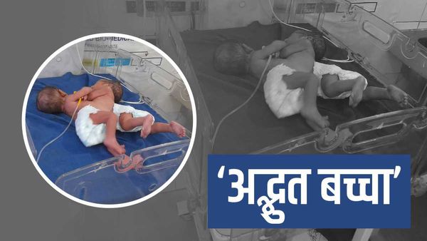 Bihar News: नवजात के जन्म के बाद डॉक्टर और परिजन हैरान, लोगों ने कहा- ये कैसे मुमकिन?
