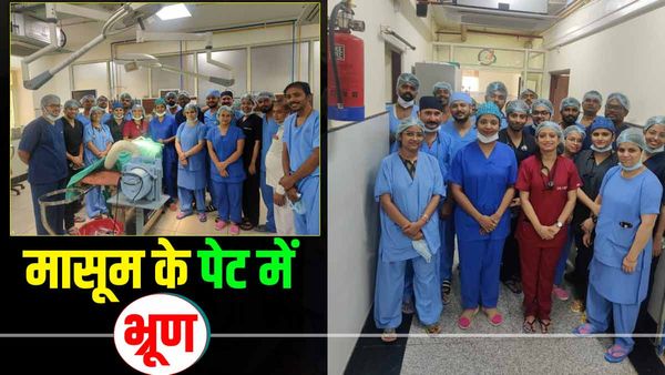 महज दो हफ्ते के मासूम की अल्ट्रासाउंड रिपोर्ट देख डॉक्टर भी हैरान रह गए, BHU में तीन घंटे तक चला ऑपरेशन