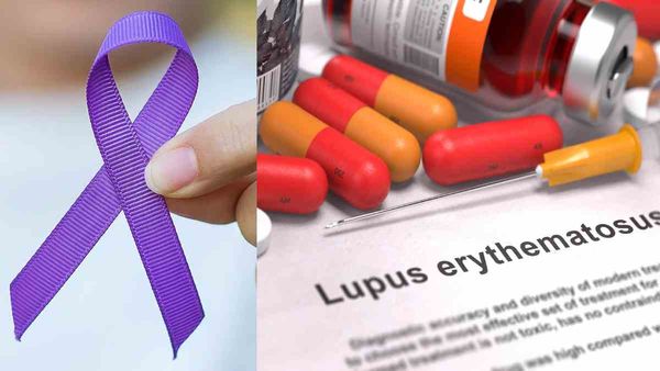 World Lupus Day: जानें क्या है ल्यूपस बीमारी, और किन अंगों को प्रभावित करती है?
