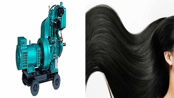 Prayagraj: समारोह में डांस करते हुए जेनरेटर में फंसे लड़की के बाल, उधड़ गई पूरी चमड़ी, जानें कैसी है हालत?