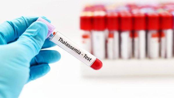 World Thalassaemia Day: क्या है थैलेसीमिया बीमारी, कैसे करती है प्रभावित, इन लक्षणों पर ध्यान देना जरूरी
