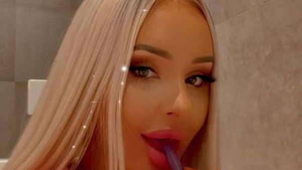 बार्बी डॉल की तरह दिखने के लिए महिला ने खर्च किए 82 लाख रुपये, गालों से लेकर जबड़े और ठुड्डी तक बदल डाले