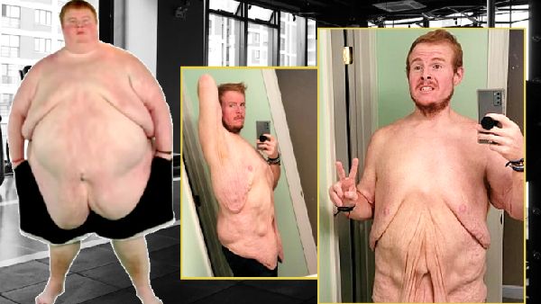 अजब-गजब! 400 किलो वजन, प्राइवेट पार्ट पोछने में भी लेनी पड़ती थी मदद, फिर एक दिन में ऐसे कम हुआ 273 किलो वजन