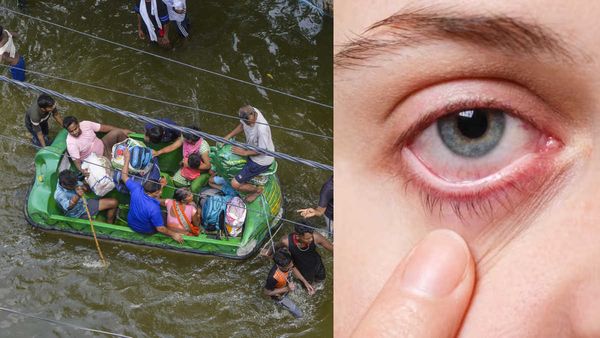 Hindon Flood: गाजियाबाद-NCR के बाढ़ प्रभावित इलाकों में बढ़ा Eye Flu का खतरा, इन बातों का रखें ध्यान