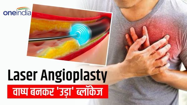 Laser angioplasty क्या है? स्टेंट के बिना खत्म कर दिया हार्ट अटैक वाल ब्लॉकेज