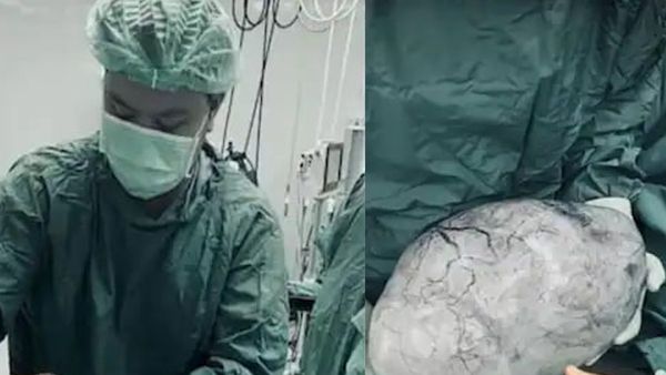 Ovarian Cyst: मोटापे से जूझ रही थी महिला, डॉक्टर के पास गई तो उड़े होश, शरीर में था 9 किलो का सिस्ट