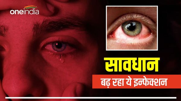 आंख से आंख मिलाई तो खतरा, जबलपुर समेत कई शहरों में 'आई फ्लू' के केस, अलर्ट मोड पर स्वास्थ्य महकमा