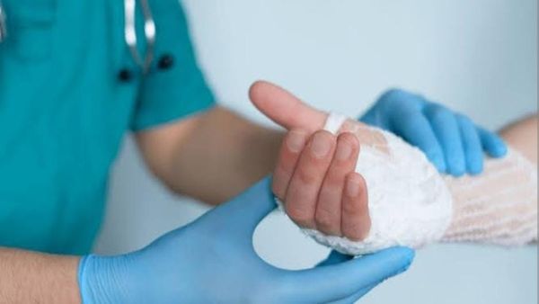 आरा मशीन से कटे हाथ को हमीदिया अस्पताल में 13 डॉक्टरों की टीम ने 8 घंटे में जोड़ा, मैराथन सर्जरी का सफल ऑपरेशन