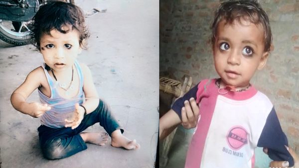 Hamirpur: Chickenpox से एक ही गांव में 3 मासूमों की मौत, चेचक की चपेट में 1 दर्जन अन्य बच्चे