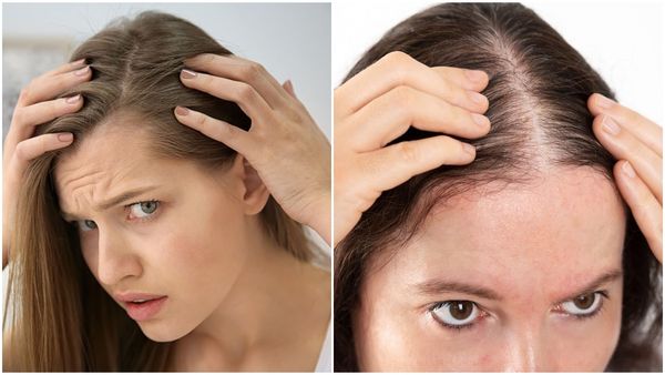 Hair Growth Tips: सिर्फ 1 ही हफ्ते में हो जाएंगे घने बाल, घर बैठे अपनाएं ये 4 आसान टिप्स जल्दी होगी ग्रोथ