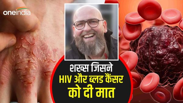 HIV और कैंसर जैसी बीमारी से जूझ रहा था ये शख्स, ऐसे हुआ इलाज और बच गई जान, डॉक्टर भी हुए हैरान
