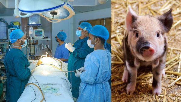 डॉक्टरों ने इंसान में ट्रांसप्लांट कर दी सुअर की किडनी, एक महीने बाद ऐसी हो गई हालत