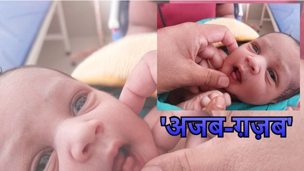 Muzaffarpur: 'OMG! अजब-ग़ज़ब', दो दांत के साथ नवजात ने लिया जन्म, डॉक्टर ने बताया आख़िर क्यों होता है ऐसा?