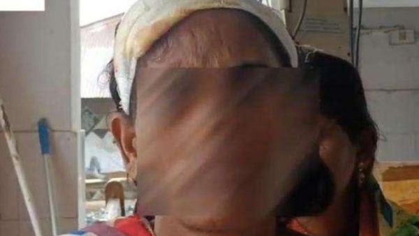 बिहार: पटना में दलित महिला को निर्वस्त्र कर पीटा और पिलाया पेशाब,1500 के कर्ज के लिए पार की हदें