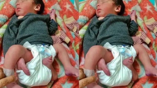 AJAB-GAZAB: 4 हाथ और 4 पैर के साथ हुआ बच्चे का जन्म, नवजात के इलाज के लिए चिंतित परिवार