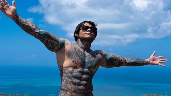 ये कैसा पागलपन है! सिर्फ दो इंच कद बढ़वाने के लिए दर्दनाक प्रक्रिया से गुजरा शख्स, ऑपरेशन के बाद बयां किया हाल