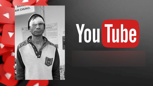 Baghpat News: 'यूट्यूब का मजा.. जिंदगी भर की सज़ा..', पति को देख पत्नी ने खोया आपा.. आंख में घोंप दी कैंची