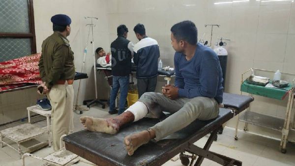 Gorakhpur News: पुलिस मुठभेड़ में लूट मामले में वांछित दो बदमाशों को लगी गोली