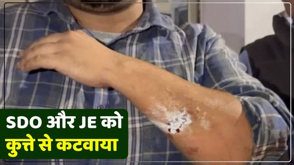 बिजली चेकिंग करने पहुंचे थे SDO और JE, उपभोक्ता ने पहले छोड़ा कुत्ता, फिर जमकर की पिटाई