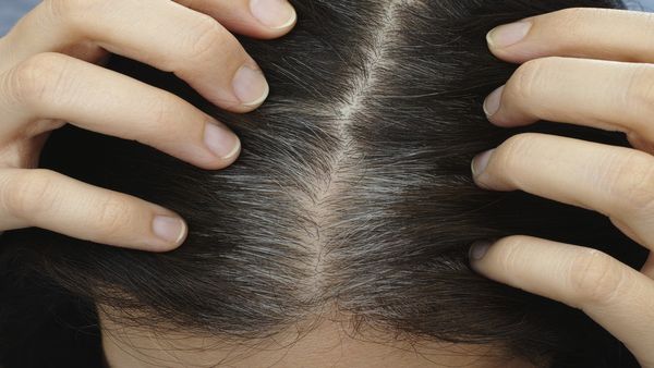 White Hair: कम उम्र में जल्दी हो रहे हैं सफेद बाल, इन उपाय से हो सकते हैं वापस काले बाल