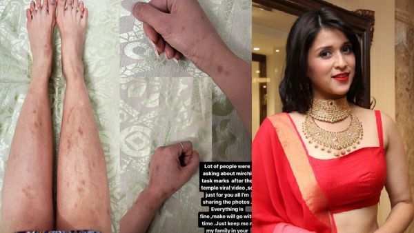 प्रियंका चोपड़ा की बहन के शरीर की हालत देख सहम जाएंगे आप, किया गया टॉर्चर, जख्मों के निशान से सिहर उठे लोग