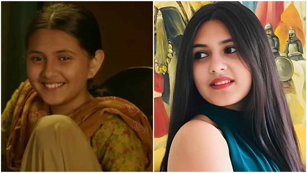 क्या है Dermatomyositis? जिसकी वजह से हुई 'छोटी बबीता' सुहानी की मौत, जानें इस खतरनाक बीमारी के लक्षण 