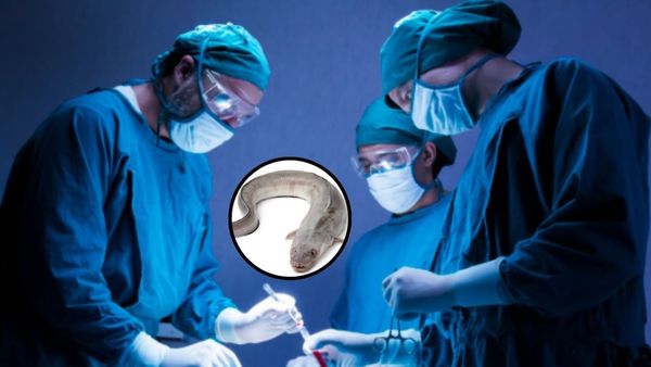 रेक्टम से शरीर में घुसी 12 इंच की मछली, अंदर कई दिनों तक रही जिंदा, आगे जो हुआ देखकर डॉक्टर्स भी रह गए हैरान