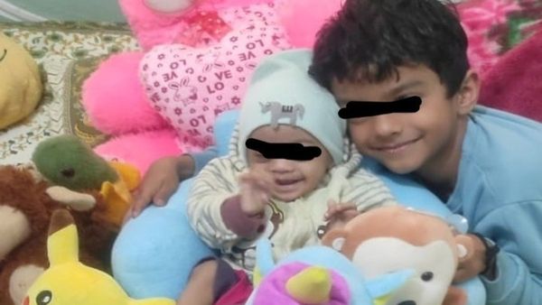 Bhopal News: एम्स में आठ माह के बच्चे को मिला नया जीवन, दिल में छेद में और डाउन सिंड्रोम से पीड़ित था बालक