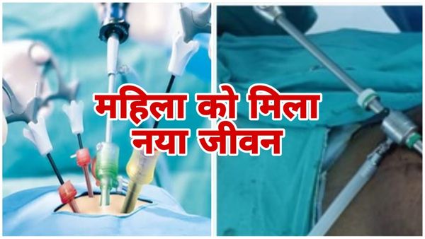 Bhopal News AIIMS: दुर्लभ रक्त विकार से पीड़ित महिला को मिला नया जीवन, तिल्ली का लेप्रोस्कोपी से सफल ऑपरेशन
