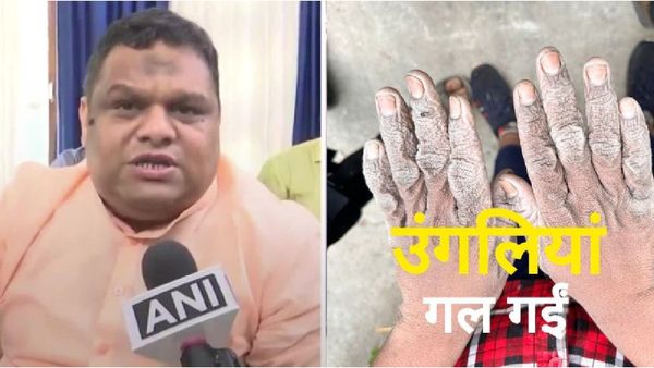 मध्य प्रदेश में शराब फैक्ट्री से बचाए गए बच्चे लापता, NCPCR के अध्यक्ष ने लगाया सनसनीखेज आरोप