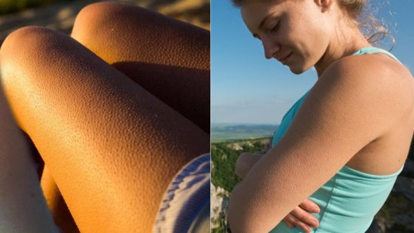 आखिर क्यों खड़े होते हैं रोंगटे? वजह जानकर हो जाएंगे हैरान