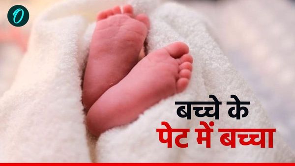 चार दिन के नवजात के गर्भ में है बच्चा, जानिए सच? रिपोर्ट देखकर क्यों चौंक गए डॉक्टर