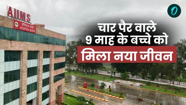 चार पैर वाले 9 माह के बच्चे को एम्स ऋषिकेश में मिला नया जीवन,जानिए डॉक्टर्स ने कैसे किया ये चमत्कार
