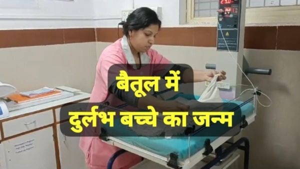 Betul News: दुर्लभ बच्चें ने लिया जन्म,जलपरी की तरह जुड़े थे दोनों पैर,10 घंटे बाद हुई मौत,चर्चा का विषय बना