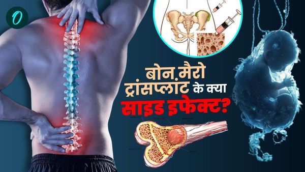 Bone Marrow Transplant क्या है? नोएडा में नवजात के लिए कैसा बना यूनिट? कितना आया खर्च? क्या डोनेट का प्रोसेस?