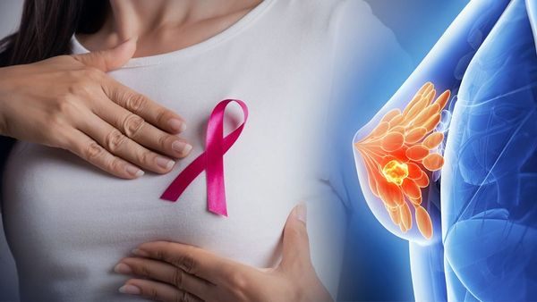 Breast Cancer: ब्रेस्ट कैंसर के ये हैं सबसे बड़े लक्षण? कहीं आप भी तो नहीं कर इग्नोर, तुरंत कराएं इलाज