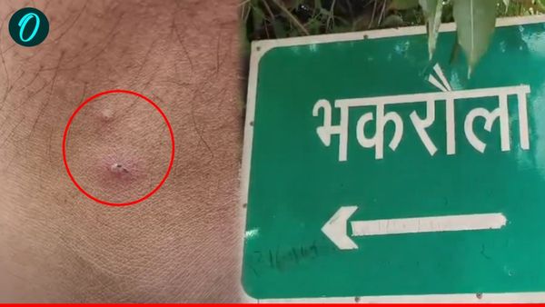 Aligarh News: रहस्यमय कीड़े के हमले से गांव में दहशत, शाम ढलते ही घरों में कैद हो रहे लोग, सूने पड़े खेत